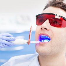 Understanding Dental Fillings: The Types and Caring for Them